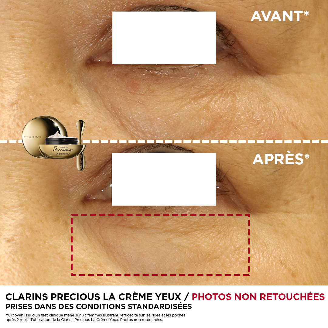 Photo avant et après l'utilisation du produit